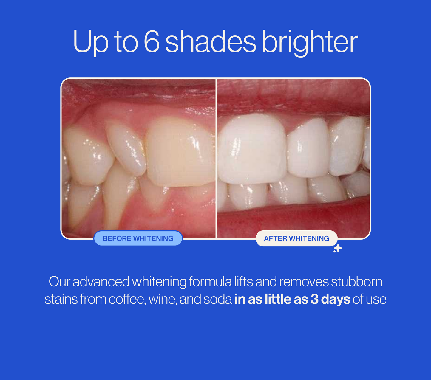 MoonWhite Whitening Tray