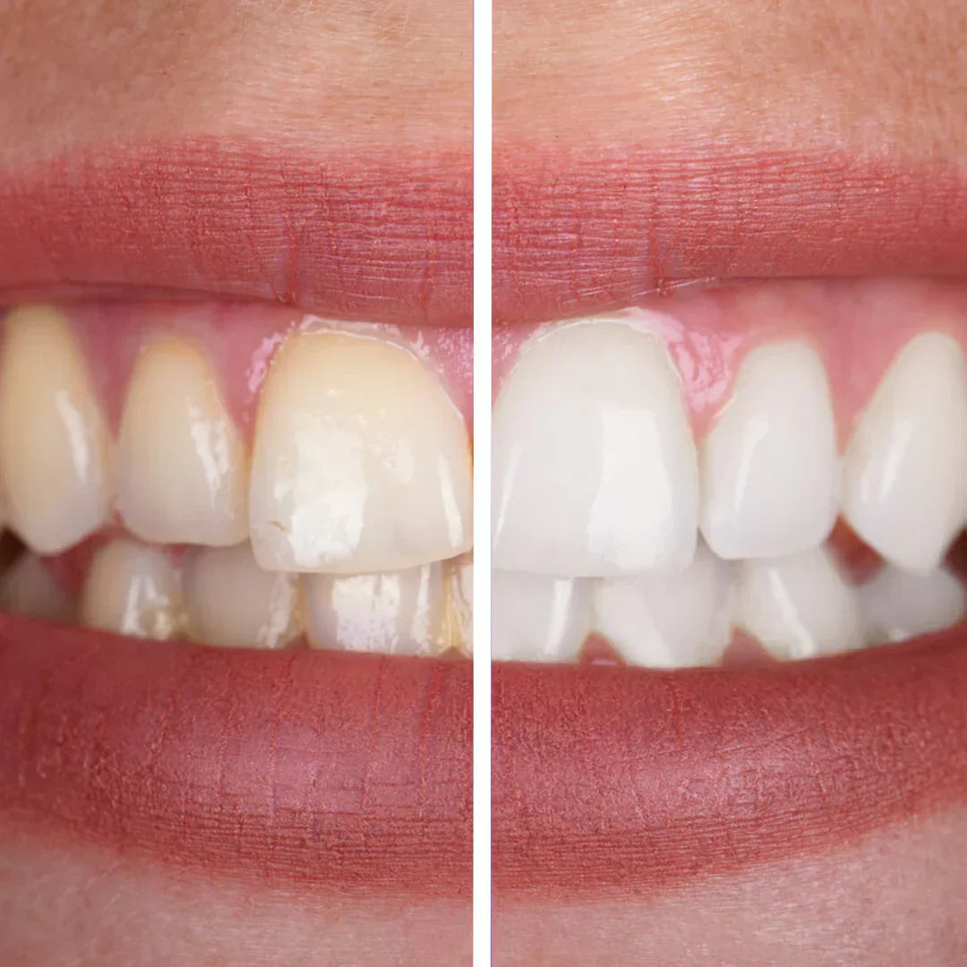 Purple Toothpaste