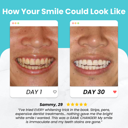 Whitening Bundle
