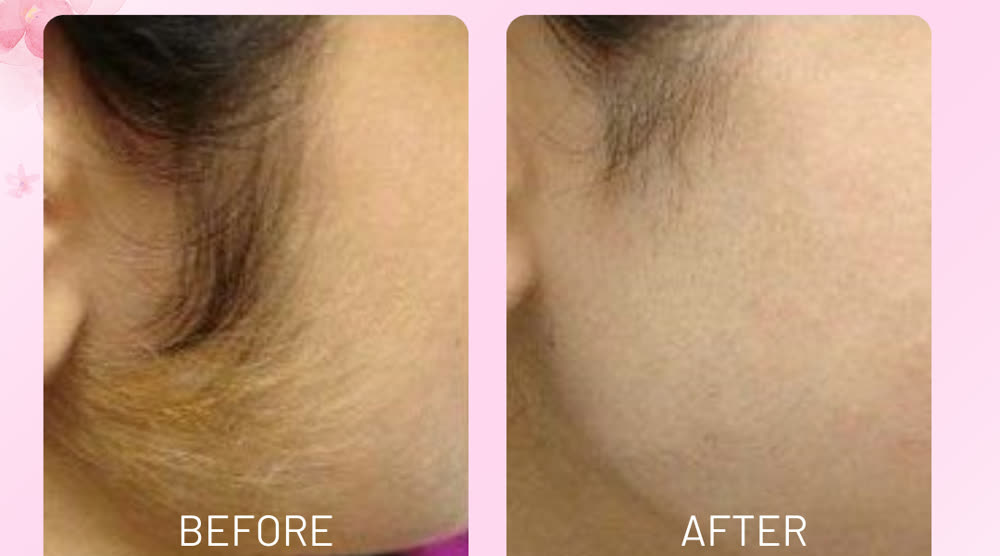 Before and after